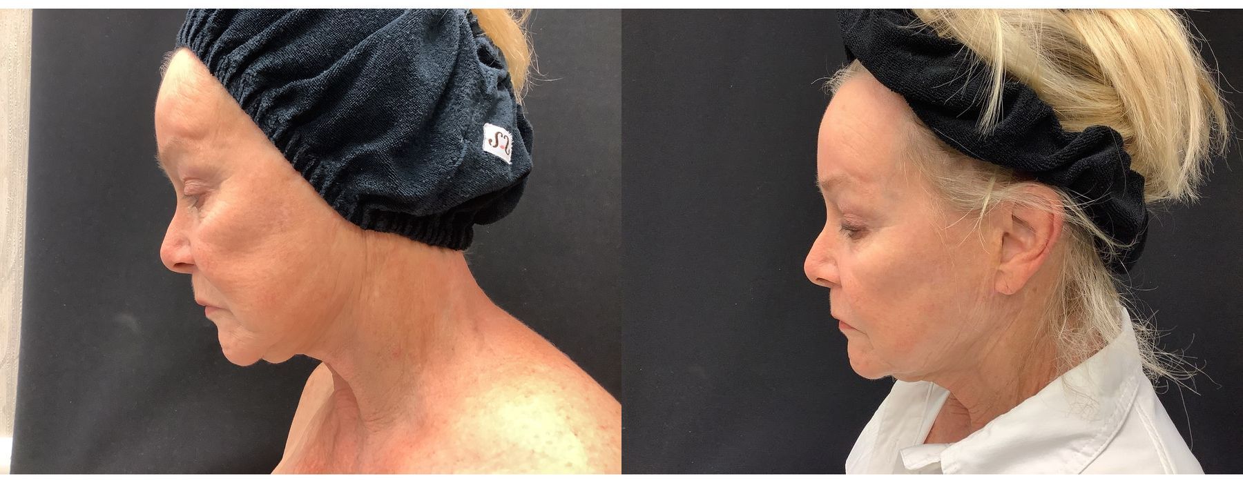 Ultra RF - Thumbnail 3