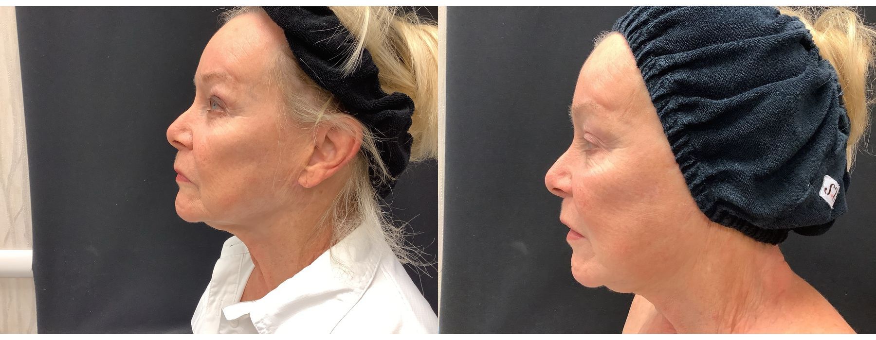 Ultra RF - Case 5345