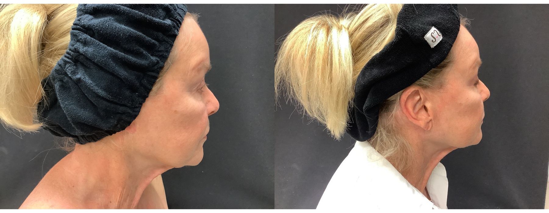 Ultra RF - Thumbnail 2