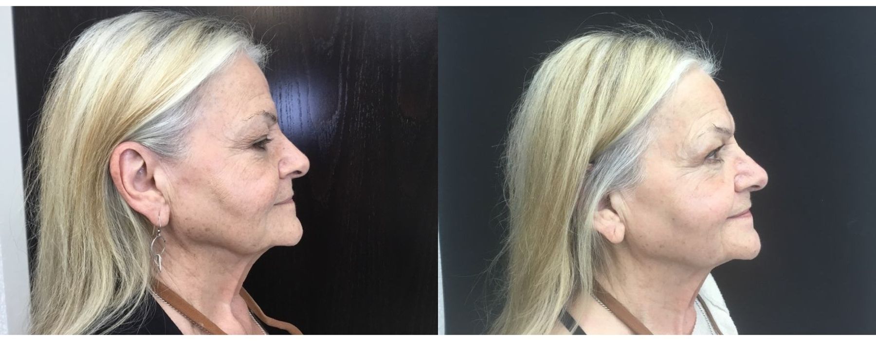 Ultra RF - Thumbnail 2