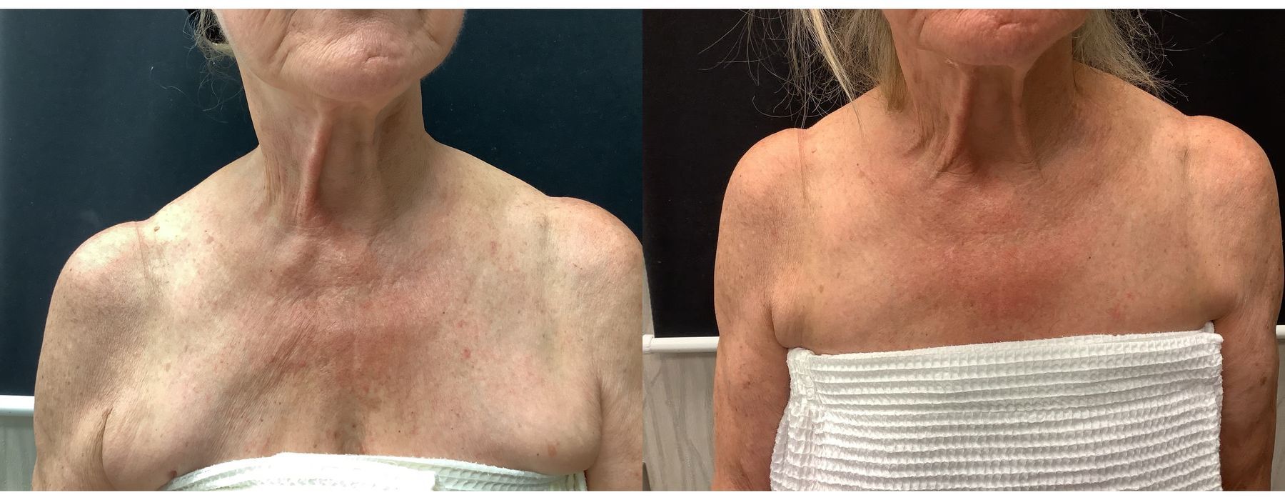 Ultra RF - Thumbnail 4