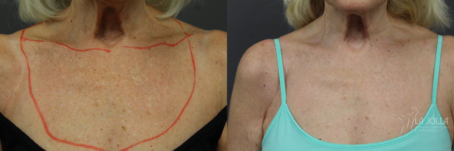 Before and after SP Dynamis case 36350