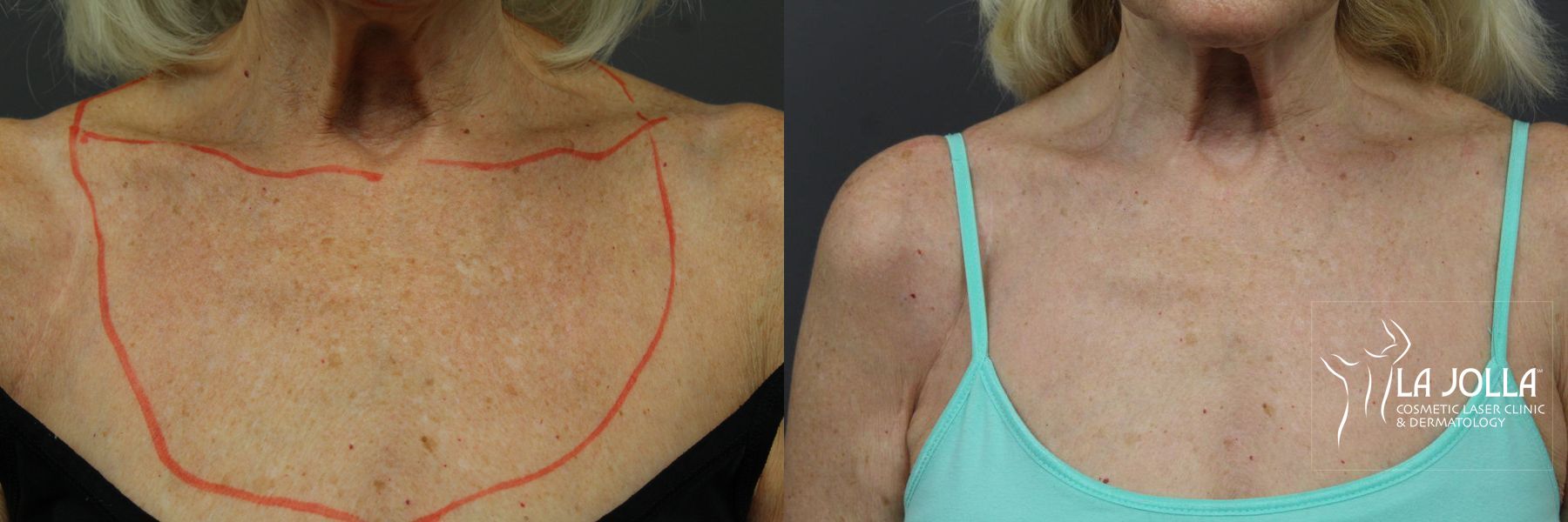 Before and after SP Dynamis case 36350