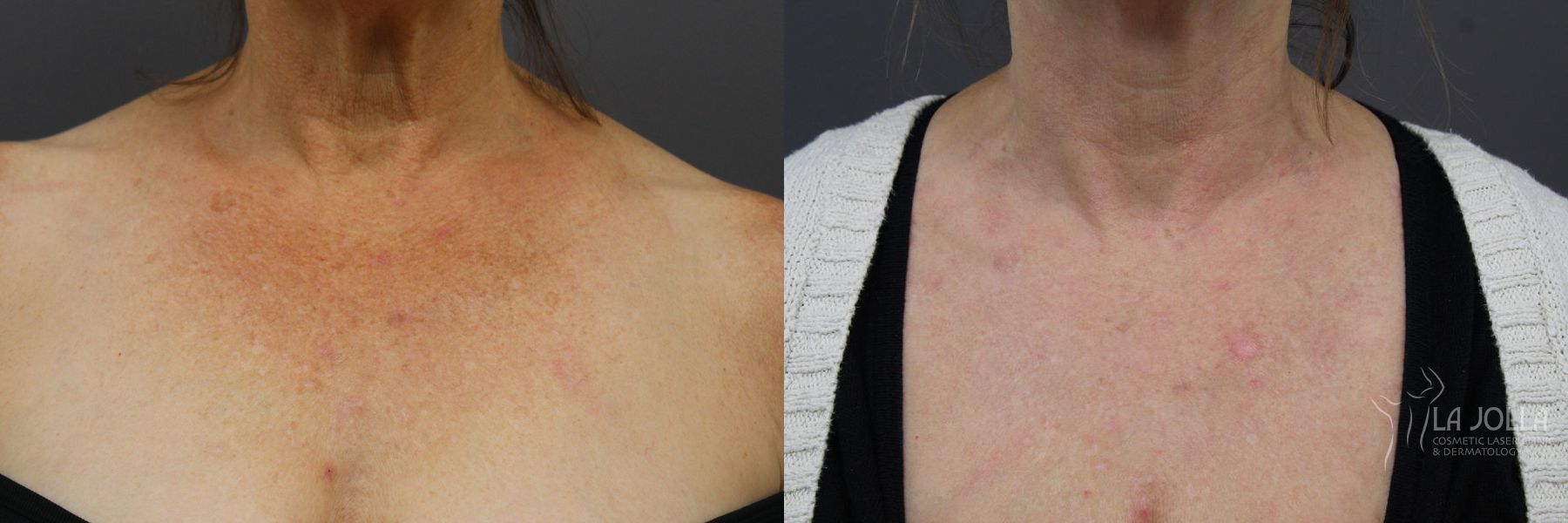 Before and after SP Dynamis case 36294