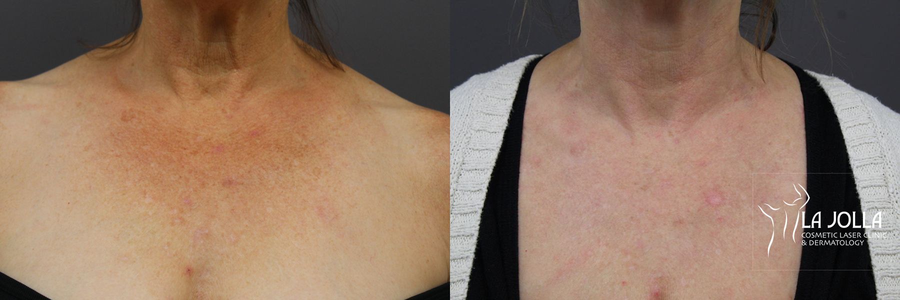 Before and after SP Dynamis case 36294