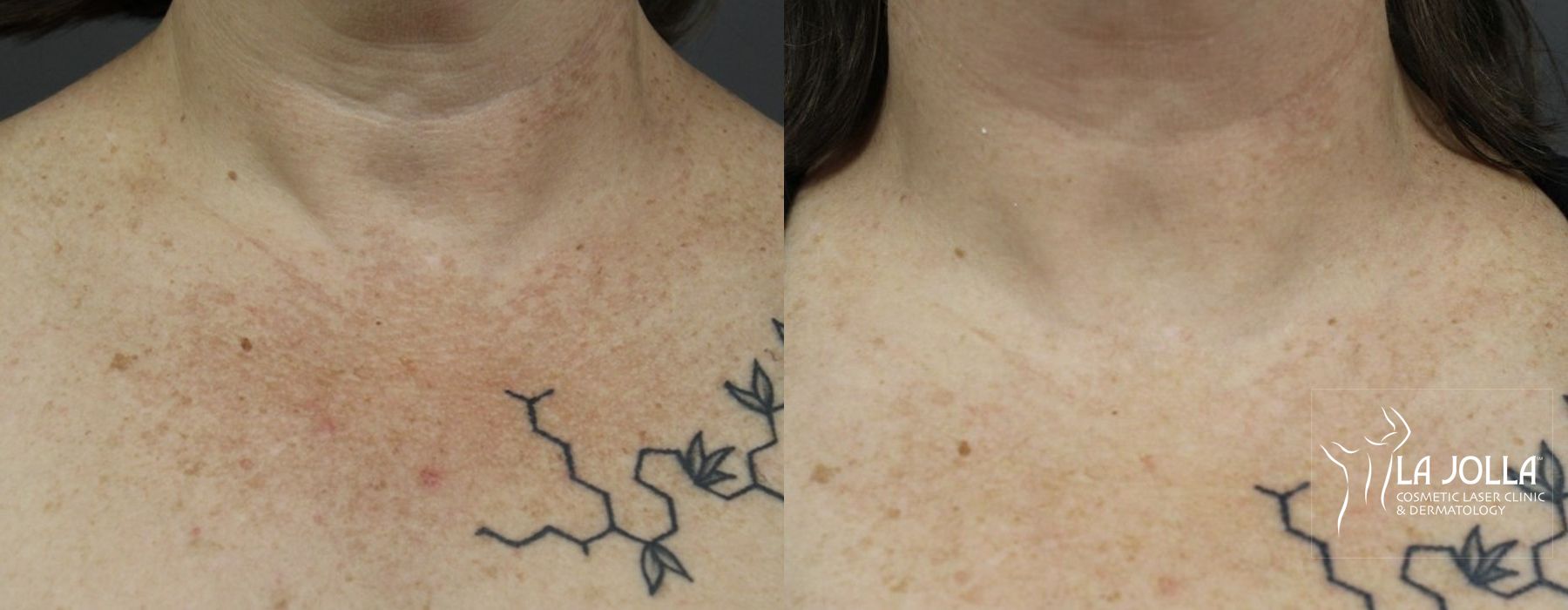 Before photo - Angle 2