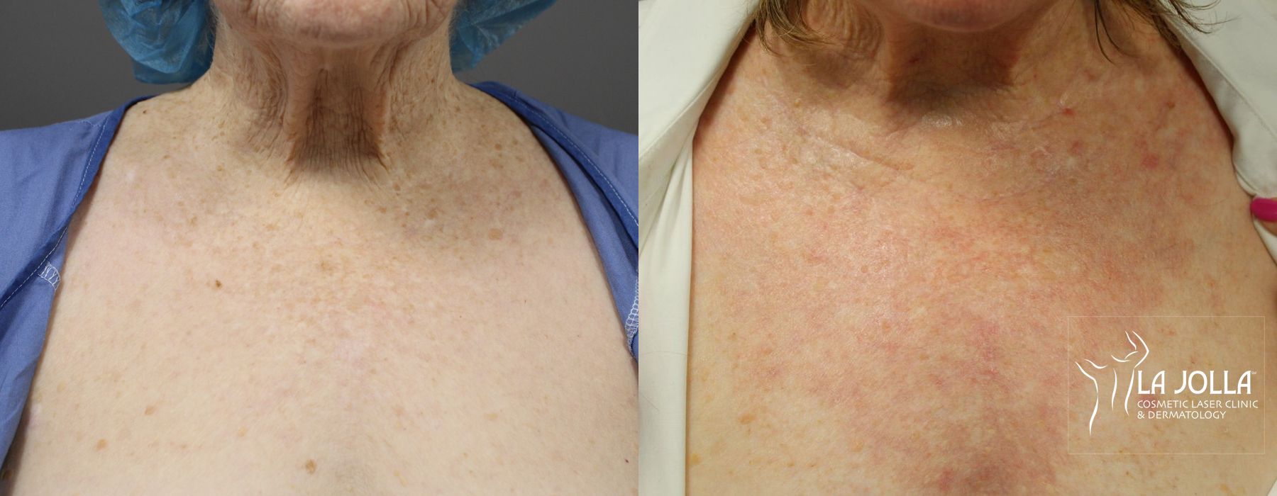 Before photo - Angle 4