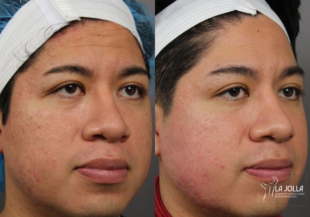 Before photo - Angle 3