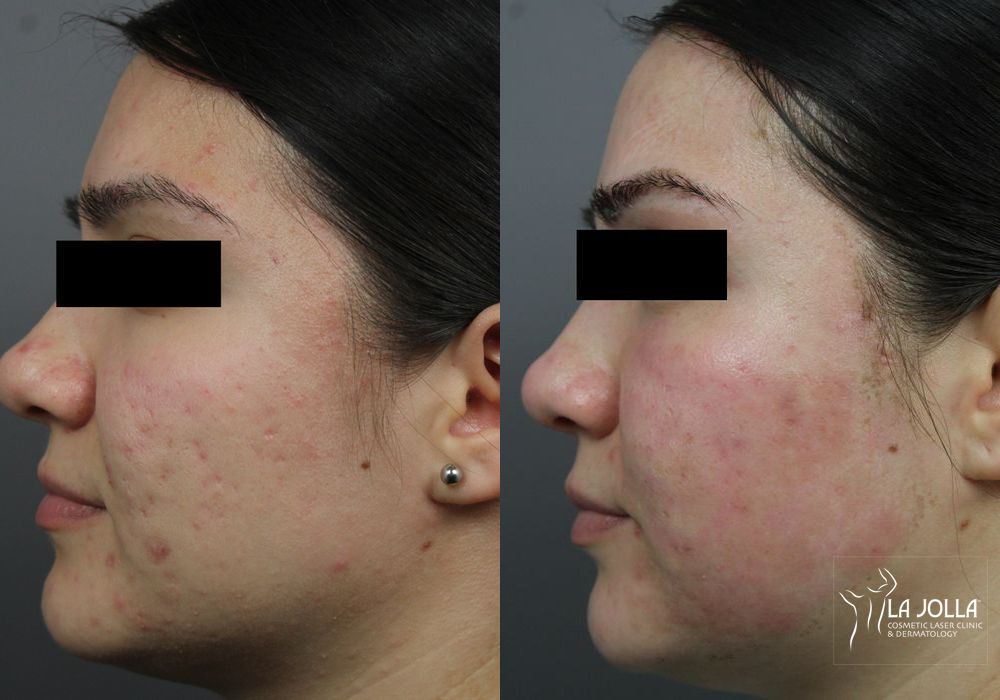 Before photo - Angle 3