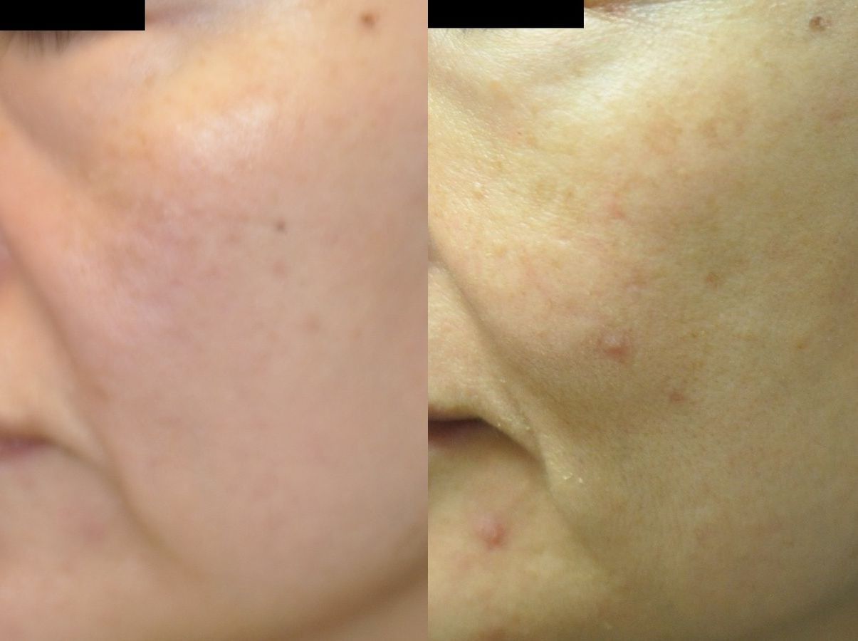 Case 35808 Case 25719