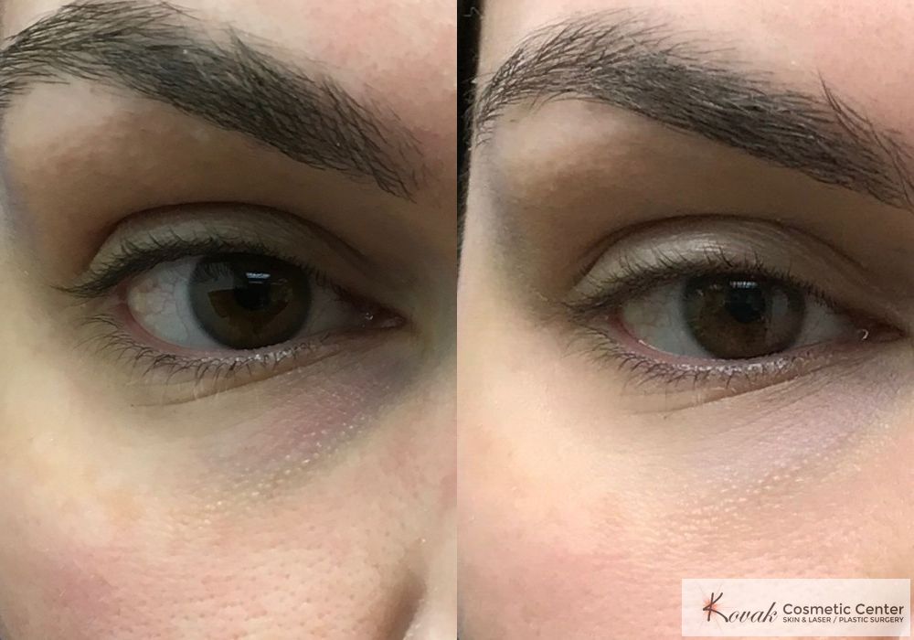 Eye Treatments - Case 1489