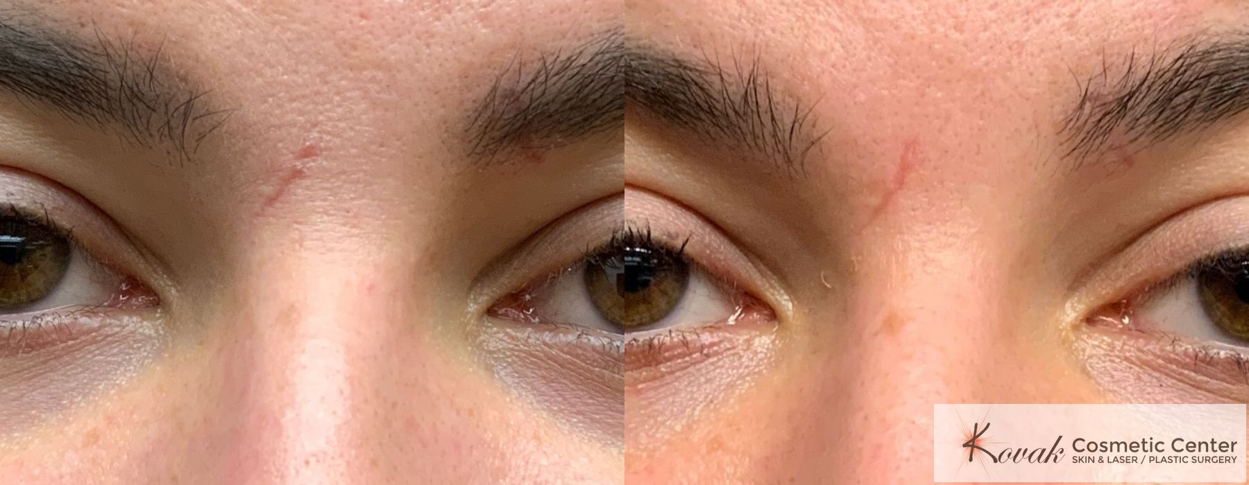 Eye Treatments - Case 1485