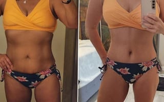Before and after Tummy Tuck case 32590 - Angle 4