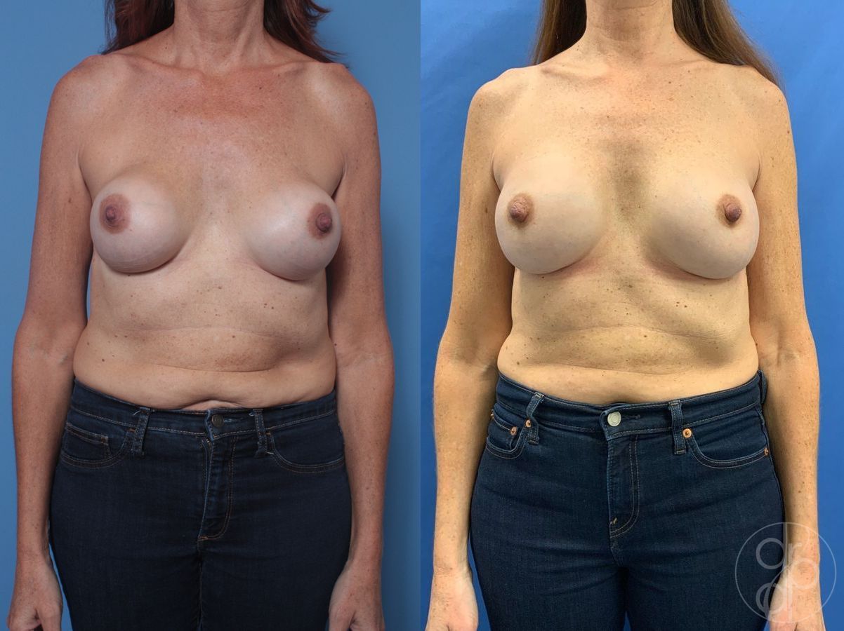 Before and after Remove & Replace case 29846