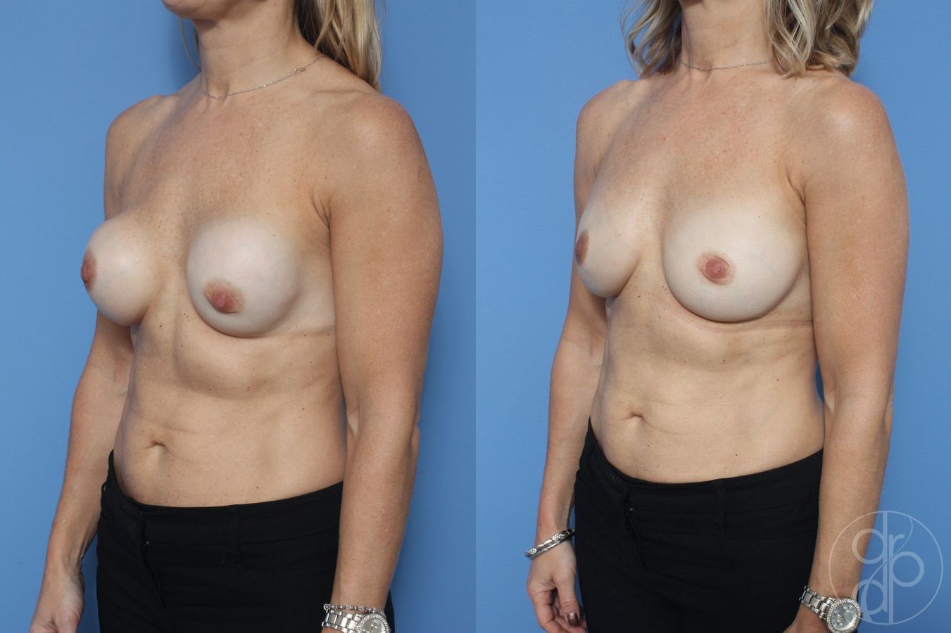 Remove & Replace - Thumbnail 3