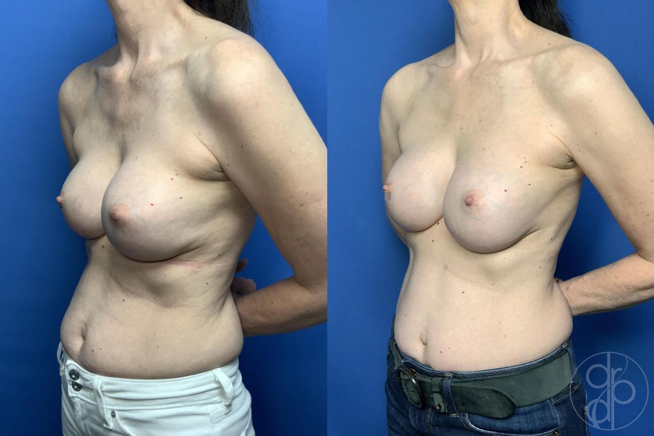 Remove & Replace - Thumbnail 2